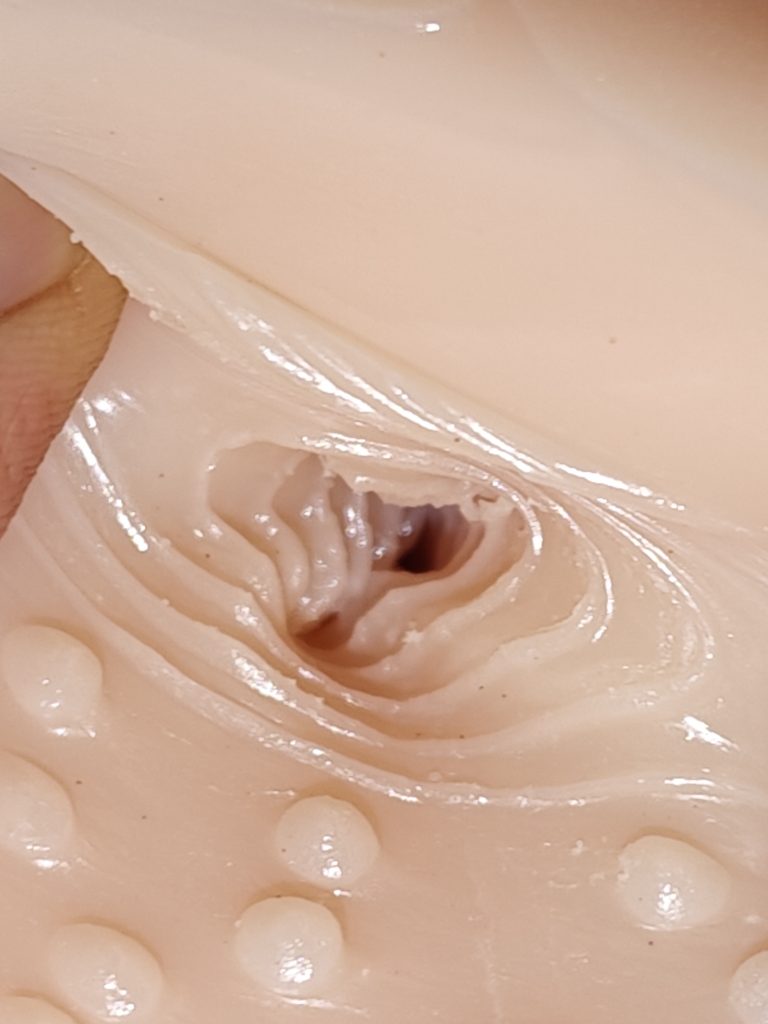 中段紧致核心区