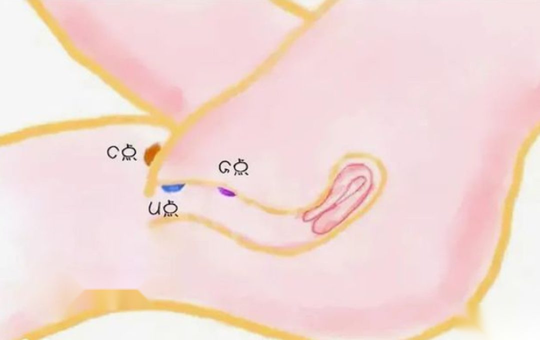 女性身体C点、U点、G点位置示意图